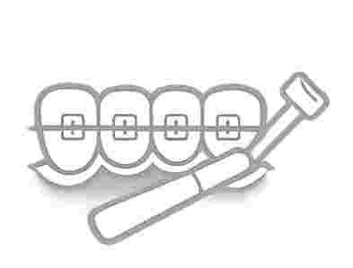 Interceptive orthodontic treatment at President Dental Centre