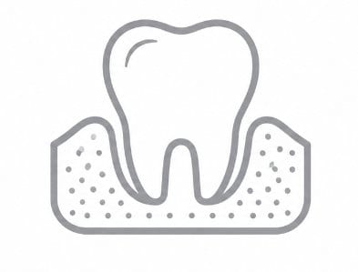 Periodontal gum treatment at President Dental Centre